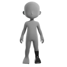 Prosthetic Lower Leg